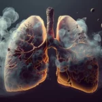 Black Lung Continues to Plague P&C Industry